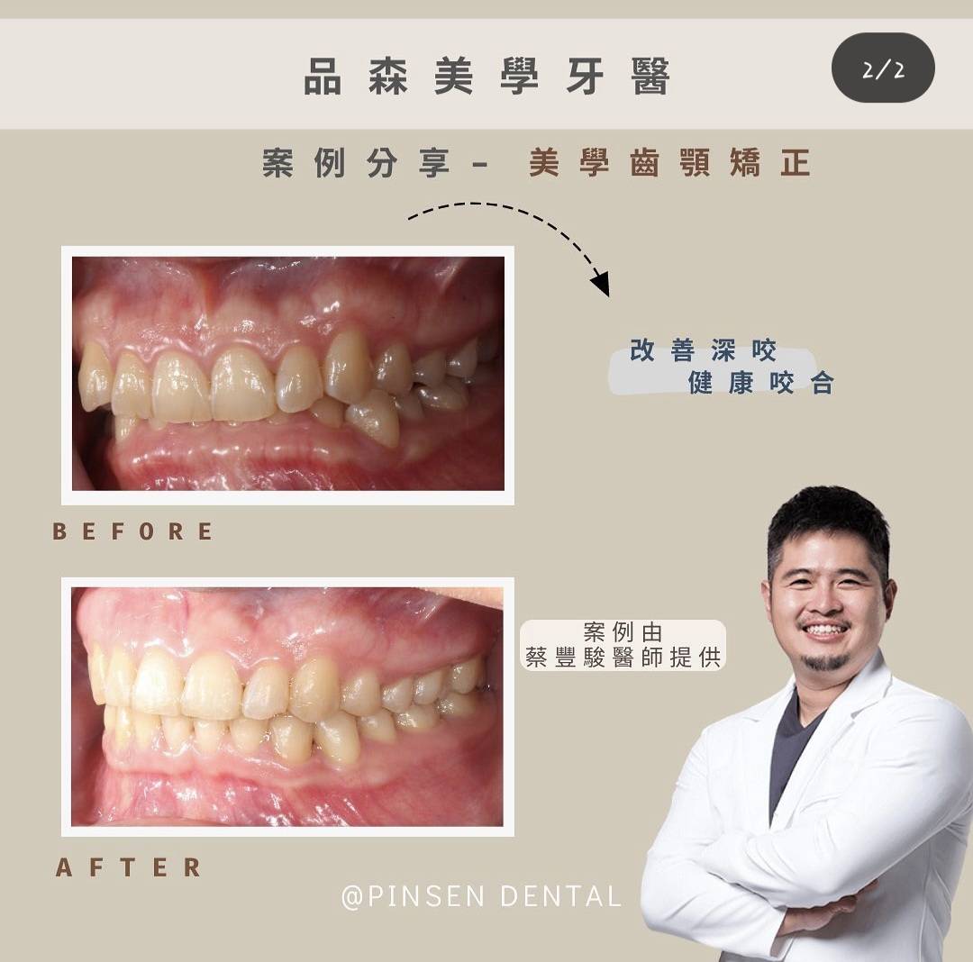 矯正案例 矯正案例