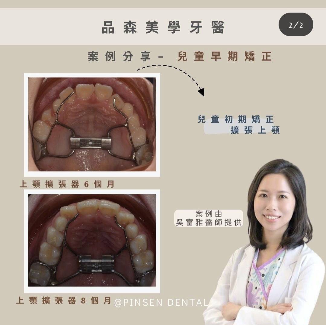 矯正案例 矯正案例